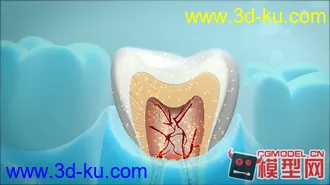 3D打印模型牙齿精模的图片